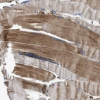 Immunohistochemical staining of human skeletal muscle shows moderate cytoplasmic positivity in myocytes.