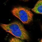 Immunofluorescent staining of human cell line U-251 MG shows localization to cytosol.