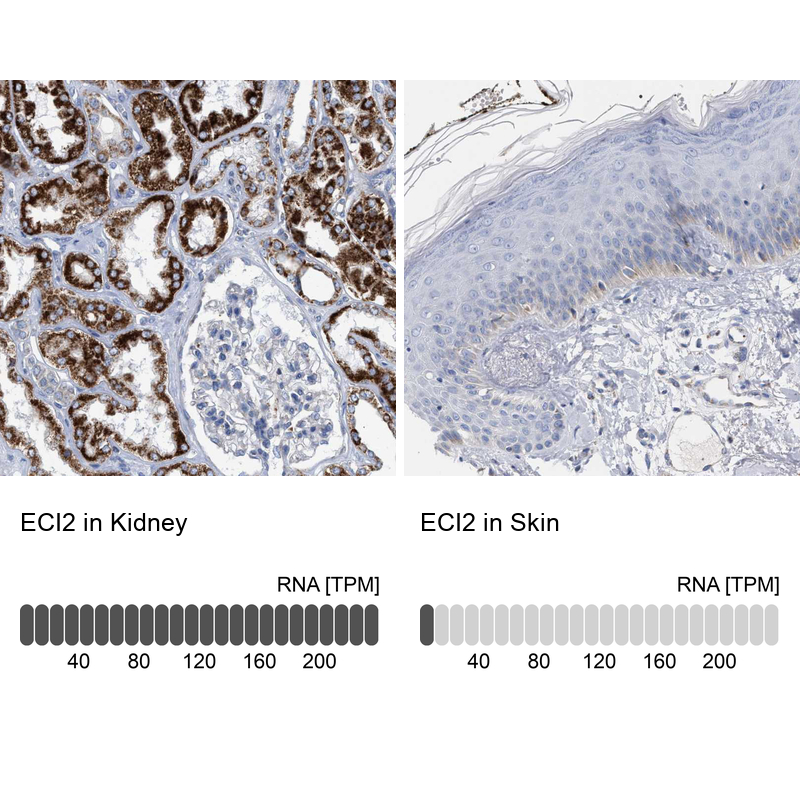 Anti-ECI2 Antibody