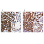 Immunohistochemical staining of human heart muscle, kidney, liver and testis using Anti-ECI2 antibody HPA022130 (A) shows similar protein distribution across tissues to independent antibody HPA031626 (B).