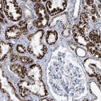 Immunohistochemical staining of human kidney shows strong granular cytoplasmic positivity in cells in tubules.