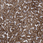 Immunohistochemical staining of human liver shows strong granular cytoplasmic positivity in hepatocytes.