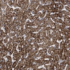 Immunohistochemical staining of human liver shows strong granular cytoplasmic positivity in hepatocytes.