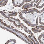 Immunohistochemical staining of human duodenum shows moderate granular cytoplasmic positivity in glandular cells.