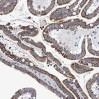 Immunohistochemical staining of human duodenum shows moderate granular cytoplasmic positivity in glandular cells.