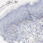 Immunohistochemical staining of human skin shows very weak positivity in epidermal cells.