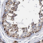 Immunohistochemical staining of human testis using Anti-ECI2 antibody HPA022130.