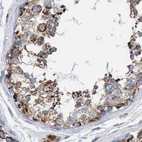 Immunohistochemical staining of human testis using Anti-ECI2 antibody HPA022130.