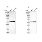 Western blot analysis using Anti-ECI2 antibody HPA022130 (A) shows similar pattern to independent antibody HPA031626 (B).