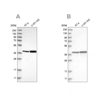Western blot analysis using Anti-ECI2 antibody HPA022130 (A) shows similar pattern to independent antibody HPA031626 (B).