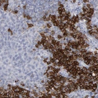 Immunohistochemical staining of human tonsil shows strong membranous/cytoplasmic positivity in non-germinal center cells.