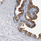 Anti-CD38 Antibody