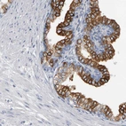 Immunohistochemical staining of human prostate shows strong membranous/cytoplasmic positivity in glandular cells.