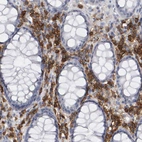 Immunohistochemical staining of human rectum shows strong membranous/cytoplasmic positivity in lymphoid cells.