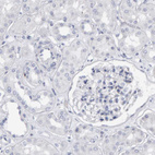 Immunohistochemical staining of human kidney shows no positivity in cells in tubules as expected.