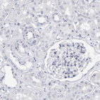 Anti-CD38 Antibody