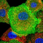 Immunofluorescent staining of human cell line A549 shows localization to plasma membrane.