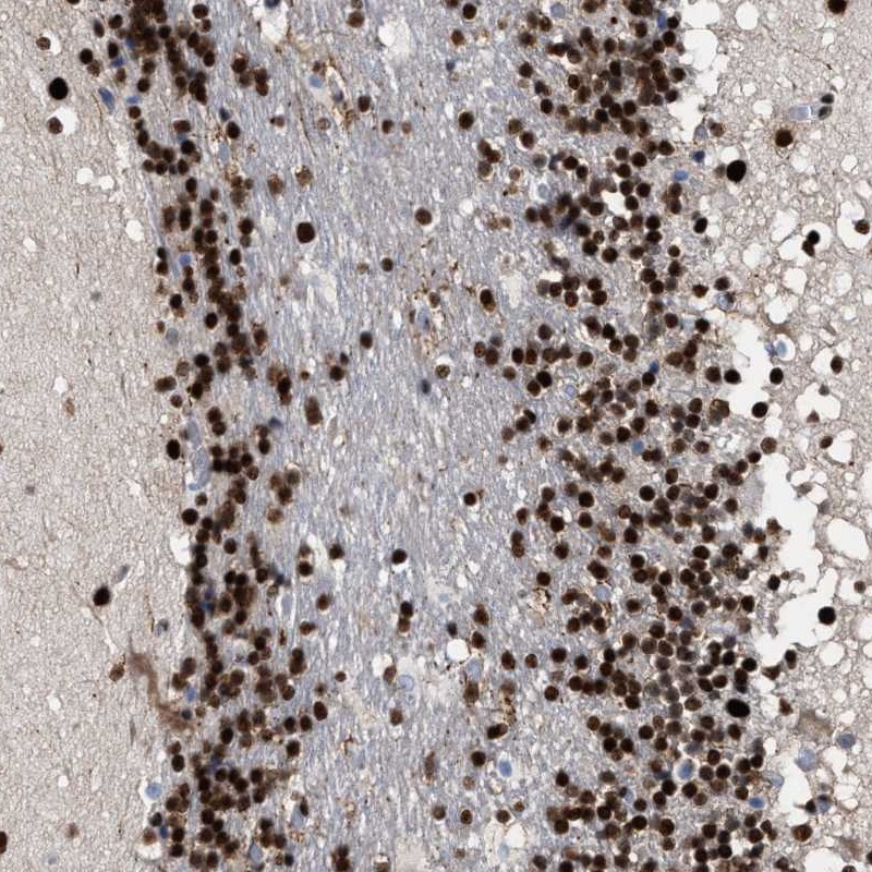 Anti-TP53BP1 Antibody