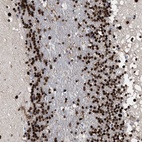 Anti-TP53BP1 Antibody