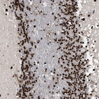 Anti-TP53BP1 Antibody