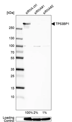 Western blot analysis in U-138MG cells transfected with control siRNA, target specific siRNA probe #1 and #2, using Anti-TP53BP1 antibody. Remaining relative intensity is presented. Loading control: Anti-GAPDH.