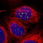 Immunofluorescent staining of human cell line A-431 shows localization to nuclear bodies.
