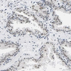 Anti-ATF2 Antibody