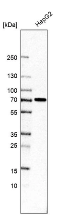 Western blot analysis in human cell line HepG2.