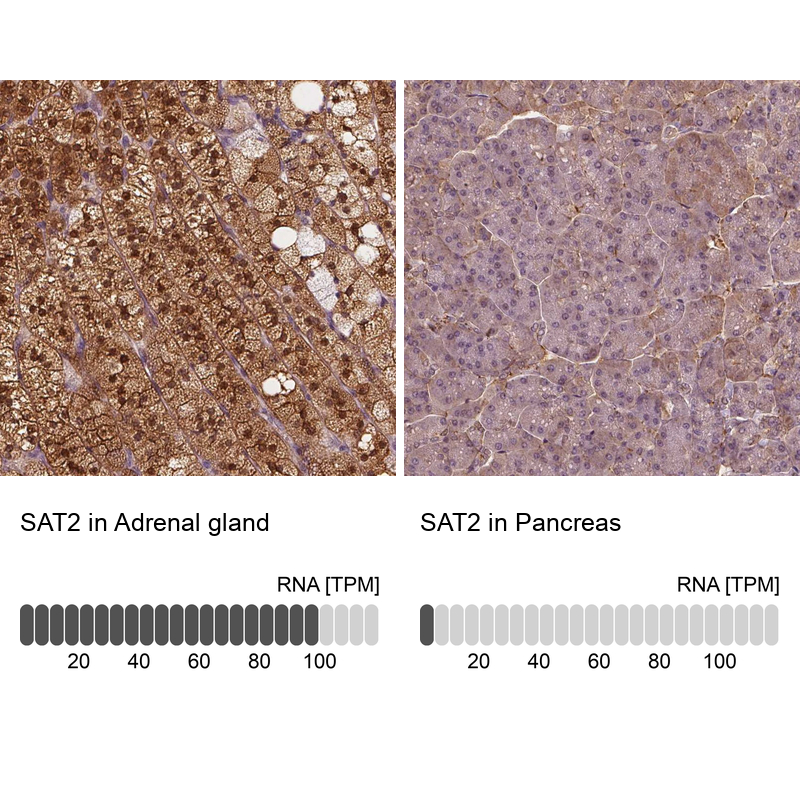 Anti-SAT2 Antibody