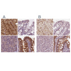 Immunohistochemical staining of human adrenal gland, colon, pancreas and small intestine using Anti-SAT2 antibody HPA022136 (A) shows similar protein distribution across tissues to independent antibody HPA057096 (B).