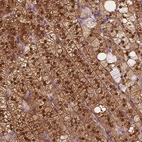 Immunohistochemical staining of human adrenal gland shows high expression.