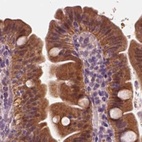 Immunohistochemical staining of human small intestine using Anti-SAT2 antibody HPA022136.
