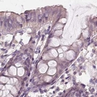 Immunohistochemical staining of human colon using Anti-SAT2 antibody HPA022136.