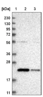 Lane 1: Marker [kDa] 230, 130, 95, 72, 56, 36, 28, 17, 11_br/_Lane 2: Human cell line RT-4_br/_Lane 3: Human cell line U-251MG sp