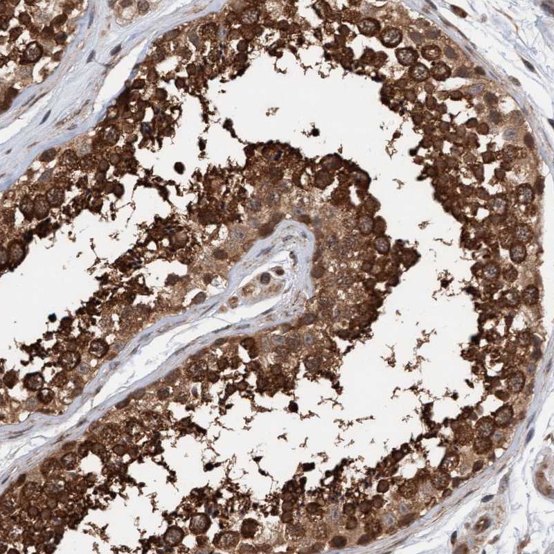 Anti-STXBP4 Antibody