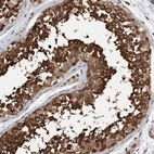 Anti-STXBP4 Antibody