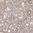 Immunohistochemical staining of human kidney shows moderate cytoplasmic positivity in cells in tubules with weak nucleus positivity.