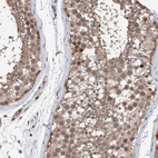 Immunohistochemical staining of human testis shows moderate cytoplasmic positivity in cells in seminiferous ducts with weak nucleus positivity.