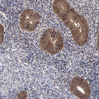 Immunohistochemical staining of human endometrium shows moderate cytoplasmic positivity in glandular cells with weak nucleus positivity.