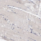 Immunohistochemical staining of human skeletal muscle shows no positivity in myocytes.
