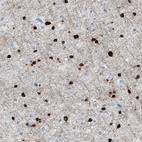 Immunohistochemical staining of human cerebral cortex shows strong nuclear and cytoplasmic positivity in glial cells.