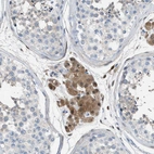Immunohistochemical staining of human testis shows moderate cytoplasmic positivity in Leydig cells.