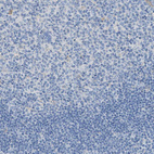 Immunohistochemical staining of human tonsil shows no positivity in germinal center cells as expected.