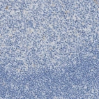 Immunohistochemical staining of human tonsil shows no positivity in germinal center cells as expected.
