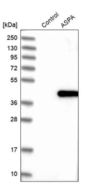 Western blot analysis in control (vector only transfected HEK293T lysate) and ASPA over-expression lysate (Co-expressed with a C-terminal myc-DDK tag (~3.1 kDa) in mammalian HEK293T cells, LY424954).