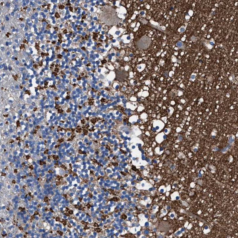 Anti-ATP6V0A1 Antibody