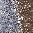 Anti-ATP6V0A1 Antibody