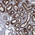 Immunohistochemical staining of human kidney shows strong granular cytoplasmic positivity in cells in tubules.