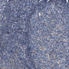 Immunohistochemical staining of human tonsil shows weak positivity in germinal center cells as expected.