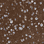 Immunohistochemical staining of human Cerebral cortex shows strong granular cytoplasmic positivity in neuropil.